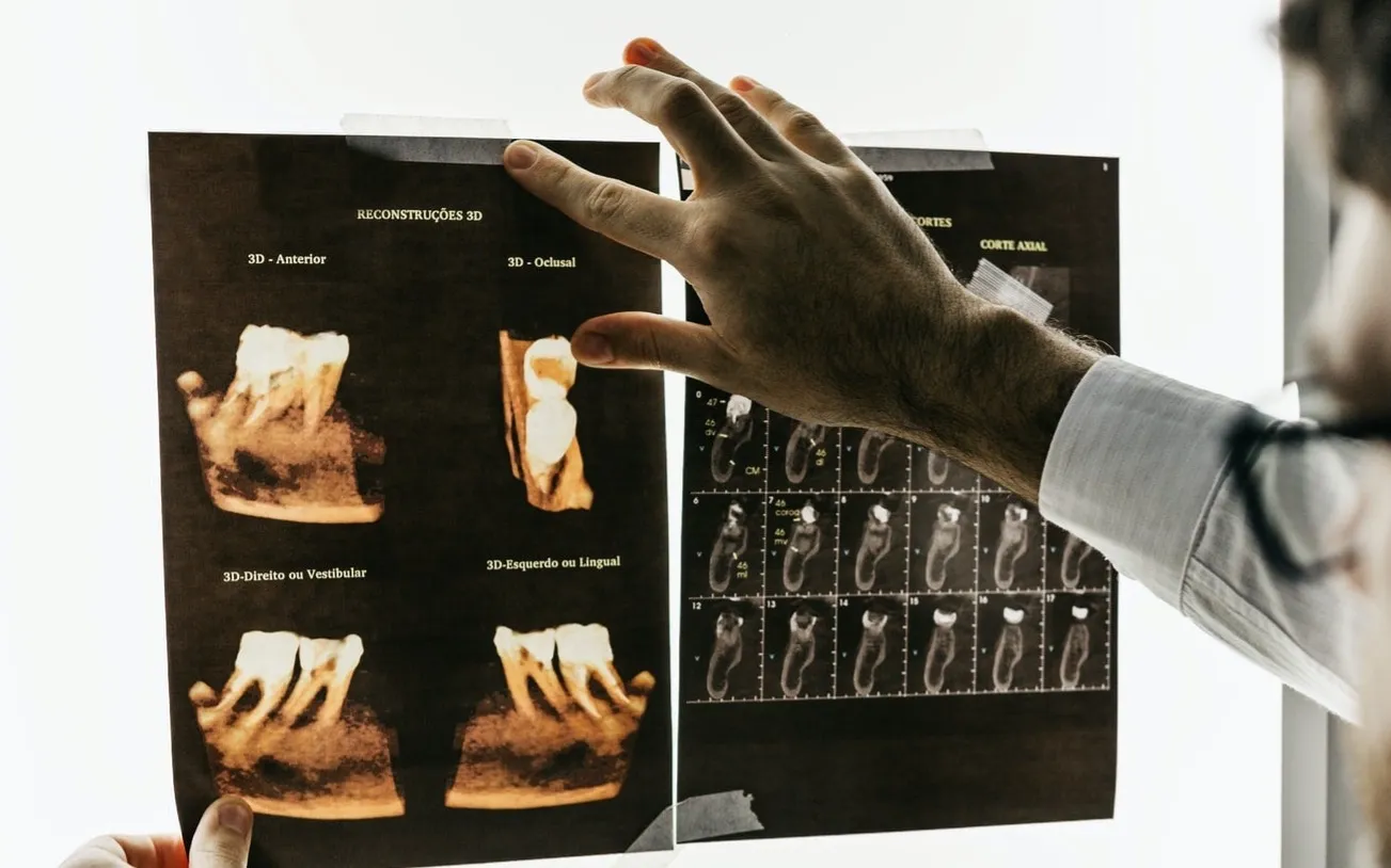 Profesional revisando a contraluz una reconstrucción radiográfica en 3D de una muela